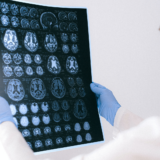 Brain