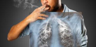 lung cancer never smoked